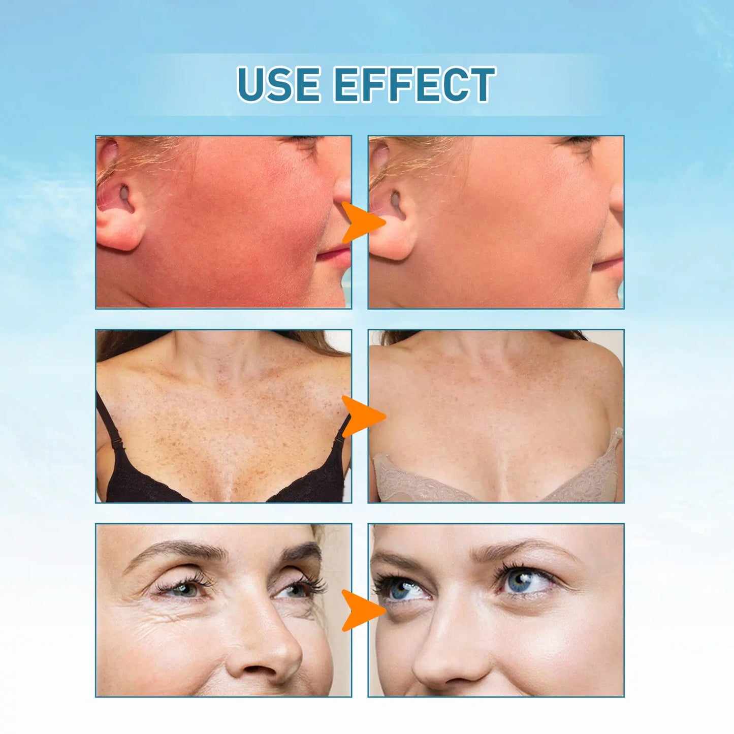 SPF90, sunscreen lotion, sun protection before uses and after effects