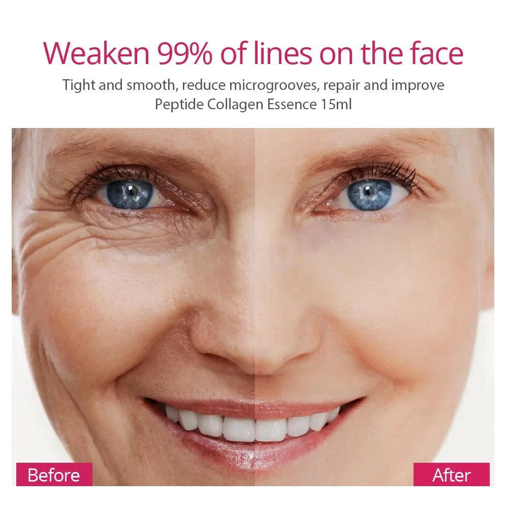 before and after effects improving Collagen Peptides Face Serum