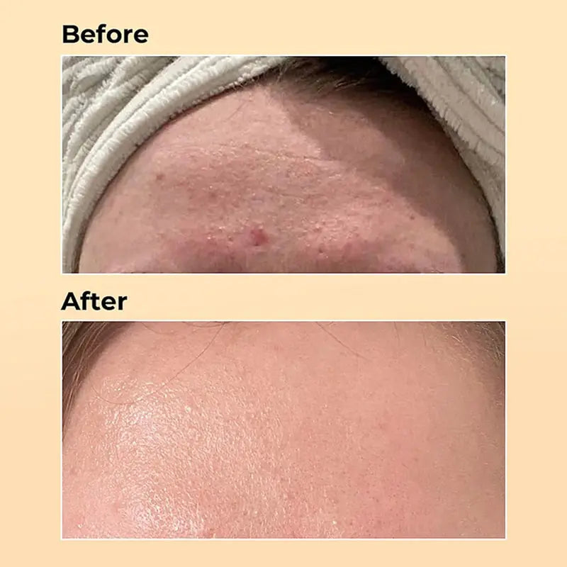 Anti-aging Repairing Essence Serum