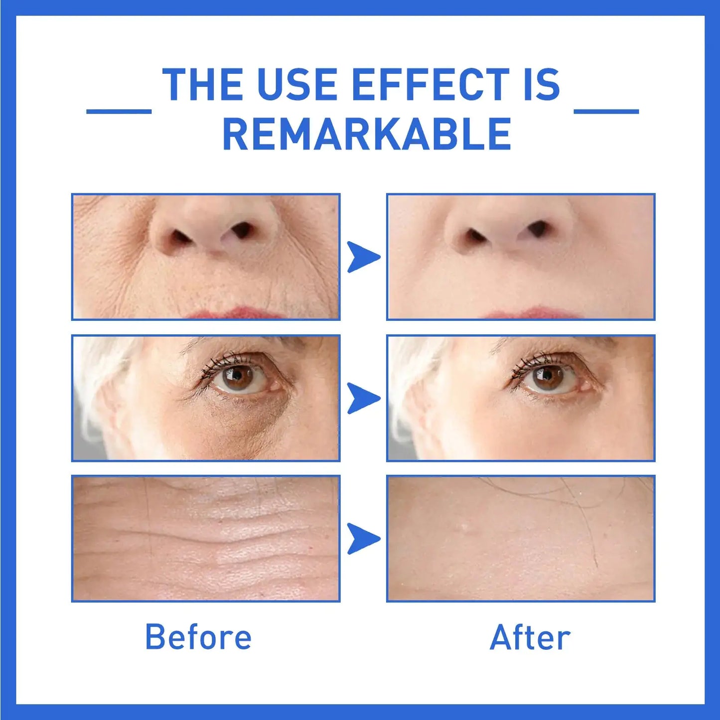 B5 Hyaluronic Acid Serum shows before and after photos.