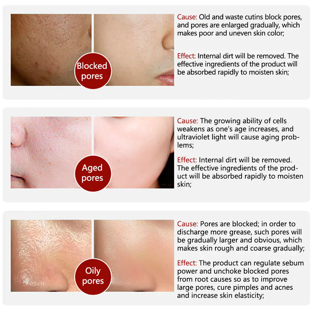 Cause and Effect of pore serum