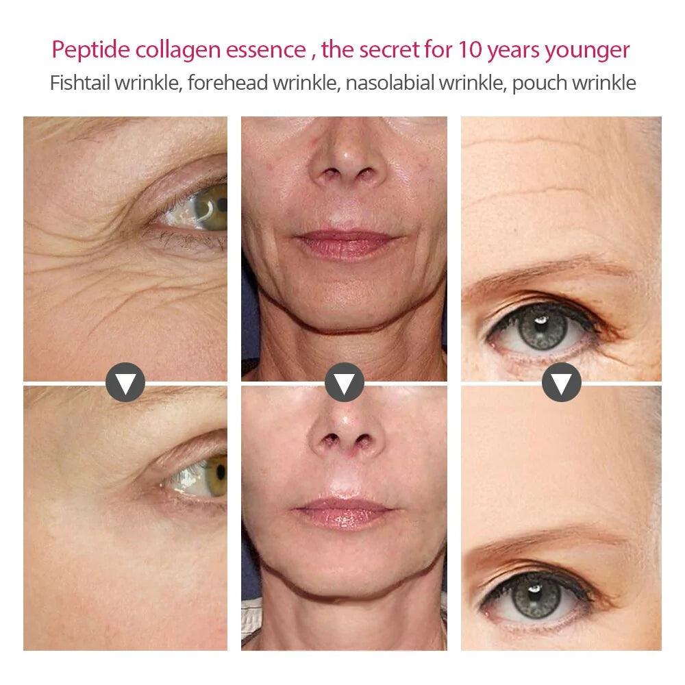 women looking ten years younger after use of product