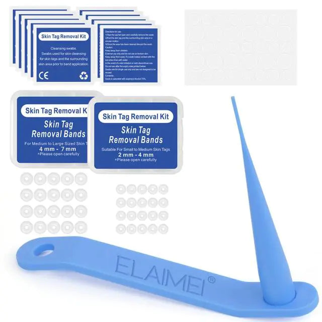 skin tag removal bands