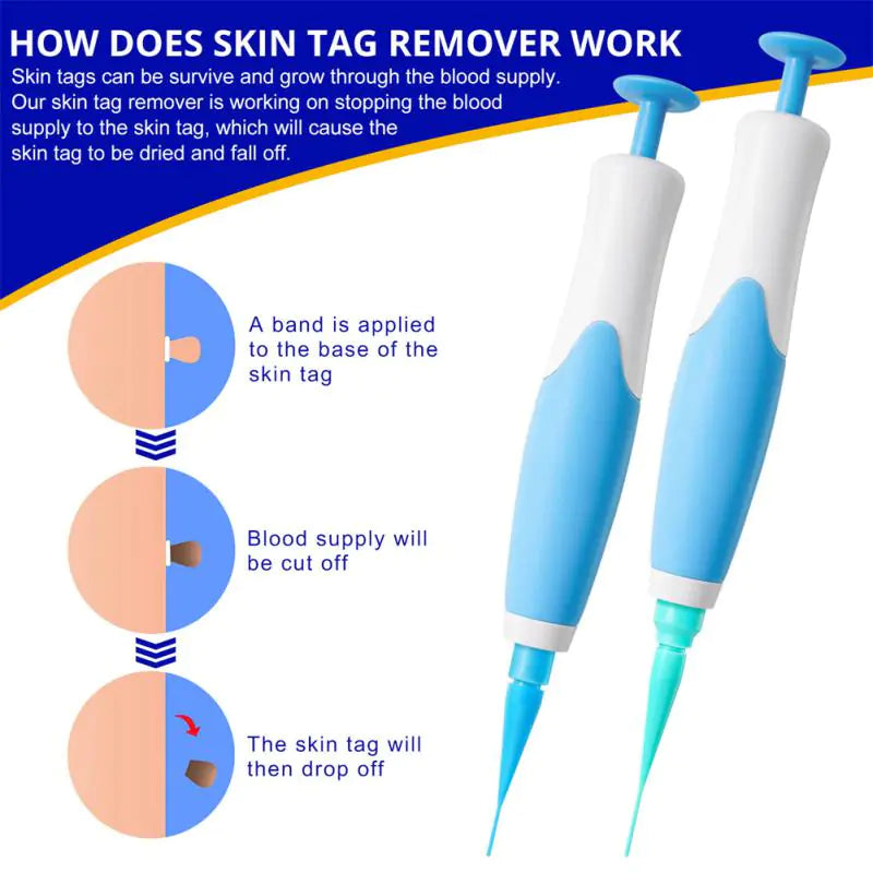 how the skin tag remover kit is successful