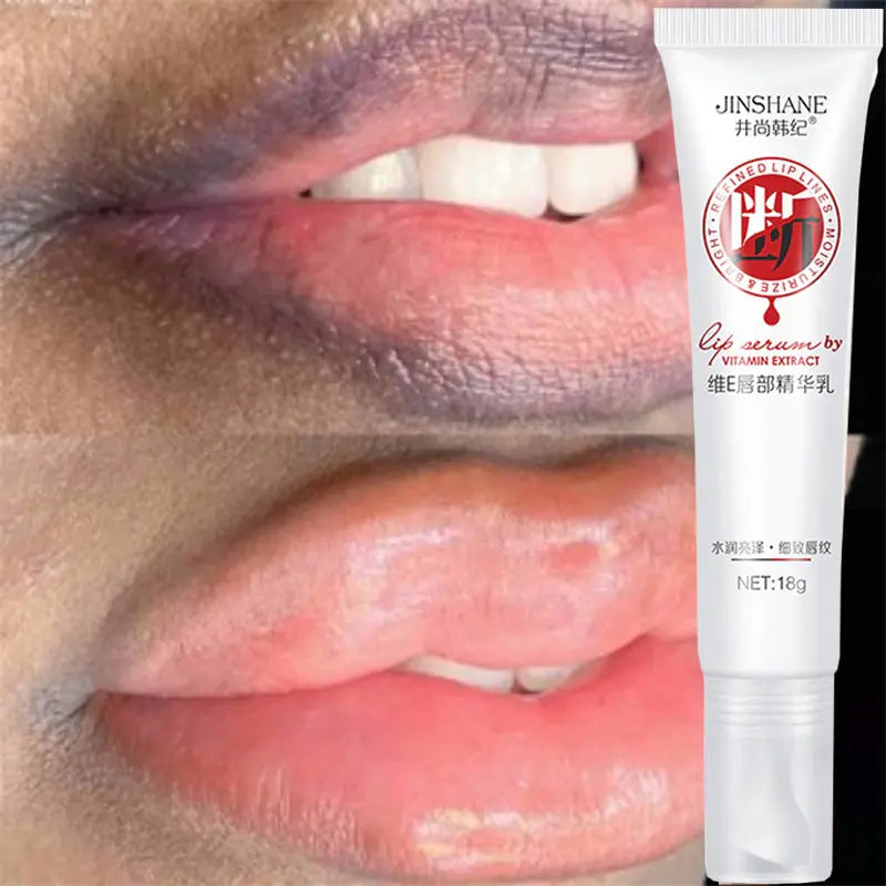 A tube of Dark Smoke Lip Treatment designed to lighten dark pigmentation and restore the natural color of lips for a brighter, healthier appearance.