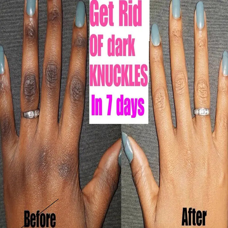 hand showing before use and after seven days