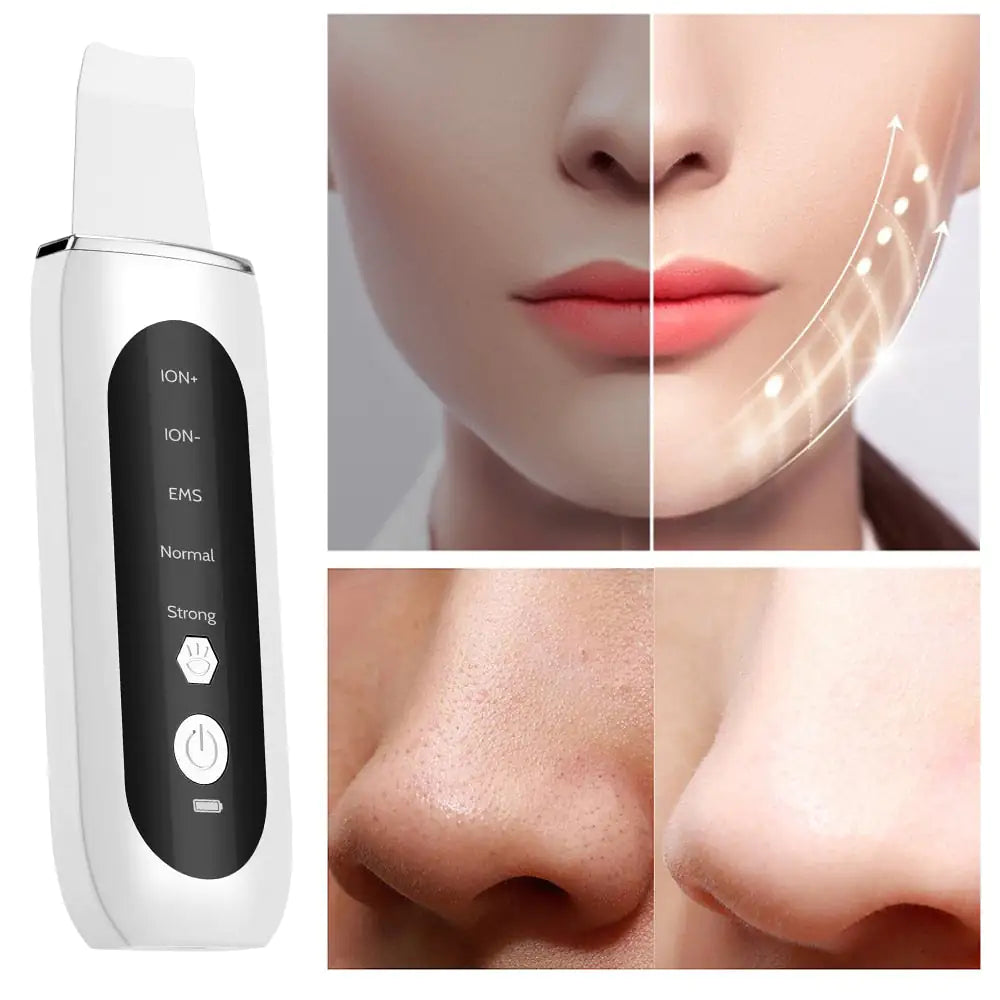 Ultrasonic Face Skin Ionization