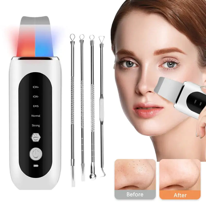 Ultrasonic Face Skin Scrubber kit