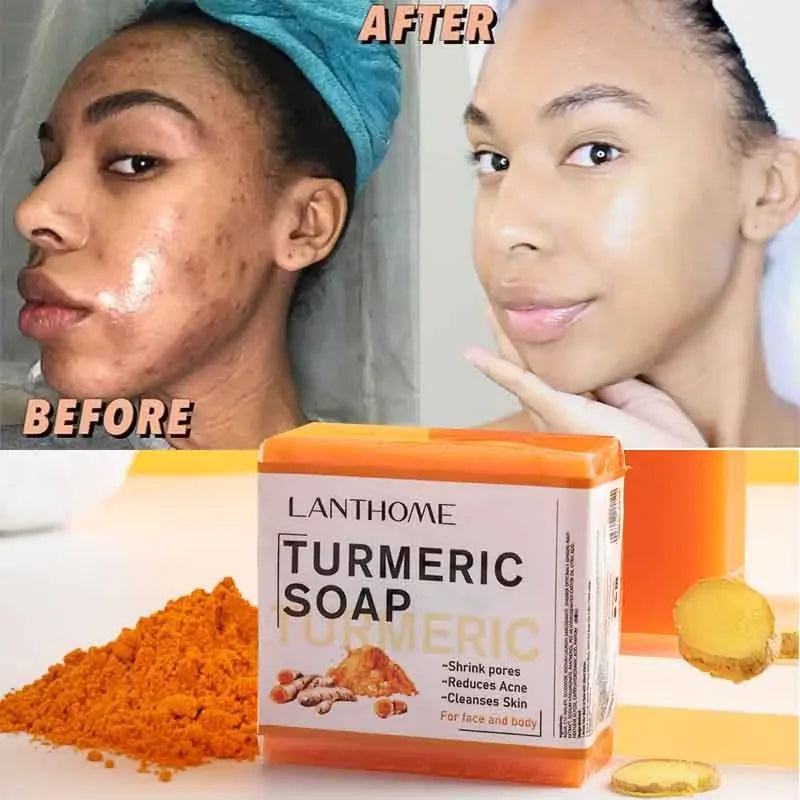before and after results from using turmeric soap