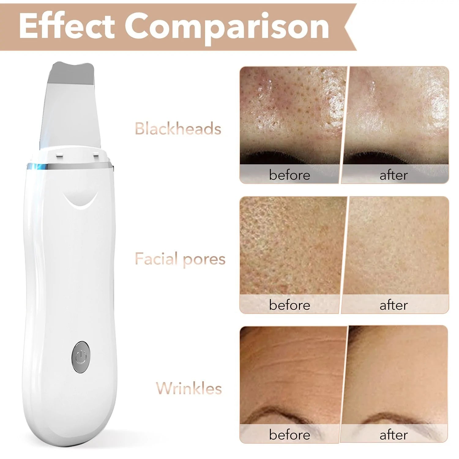 effects on black heads facial pores and wrinkles